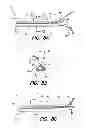 Fig. 09 - Insertion tool for paddle-style electrode