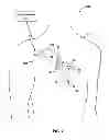 Fig. 03 - IMPLANTABLE MEDICAL DEVICE FIXATION