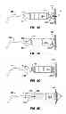 Fig. 06 - IMPLANTABLE MEDICAL DEVICE FIXATION