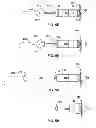 Fig. 07 - IMPLANTABLE MEDICAL DEVICE FIXATION