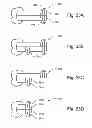 Fig. 49 - Articulating suturing device
