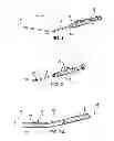 Fig. 02 - Articulating suturing device and method