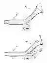 Fig. 07 - Articulating suturing device and method