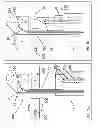 Fig. 04 - Suture passing instrumentation and methods of use thereof