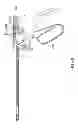 Fig. 19 - Suture passing instrumentation and methods of use thereof