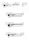 Fig. 42 - Suture passing instrumentation and methods of use thereof