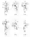 Fig. 45 - Suture passing instrumentation and methods of use thereof