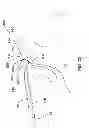 Fig. 63 - Suture passing instrumentation and methods of use thereof