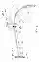 Fig. 69 - Suture passing instrumentation and methods of use thereof
