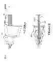 Fig. 75 - Suture passing instrumentation and methods of use thereof