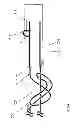 Fig. 80 - Suture passing instrumentation and methods of use thereof