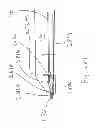 Fig. 92 - Suture passing instrumentation and methods of use thereof