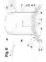Fig. 07 - Vascular anastomosis device and method