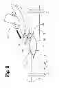 Fig. 09 - Vascular anastomosis device and method