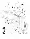 Fig. 22 - Vascular anastomosis device and method