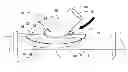 Fig. 01 - VASCULAR ANASTOMOSIS DEVICE AND METHOD