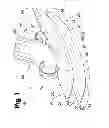 Fig. 02 - VASCULAR ANASTOMOSIS DEVICE AND METHOD