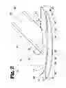 Fig. 03 - VASCULAR ANASTOMOSIS DEVICE AND METHOD
