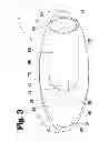 Fig. 04 - VASCULAR ANASTOMOSIS DEVICE AND METHOD