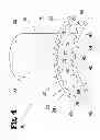 Fig. 05 - VASCULAR ANASTOMOSIS DEVICE AND METHOD