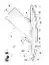 Fig. 06 - VASCULAR ANASTOMOSIS DEVICE AND METHOD