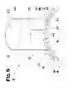Fig. 07 - VASCULAR ANASTOMOSIS DEVICE AND METHOD