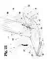 Fig. 22 - VASCULAR ANASTOMOSIS DEVICE AND METHOD