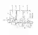 Fig. 04 - DISCECTOMY DEVICES AND METHODS