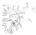Fig. 01 - Lancing device for collecting body fluid samples