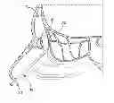 Fig. 01 - Sinus dilation system and method