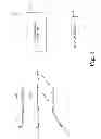 Fig. 02 - Sinus dilation system and method