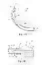 Fig. 06 - Sinus dilation system and method