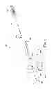 Fig. 08 - Sinus dilation system and method