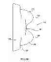 Fig. 07 - Neuromuscular therapy device and method