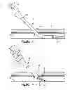 Fig. 03 - Vascular locating systems and methods of use