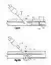 Fig. 15 - Vascular locating systems and methods of use