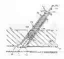 Fig. 01 - Apparatus and methods for sealing a vascular puncture
