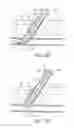 Fig. 11 - Apparatus and methods for sealing a vascular puncture