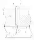 Fig. 01 - Apparatus for closing vascular puncture