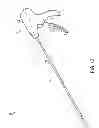 Fig. 09 - System for securing sutures