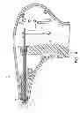 Fig. 11 - System for securing sutures
