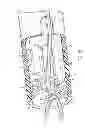 Fig. 12 - System for securing sutures
