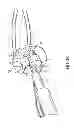 Fig. 15 - System for securing sutures