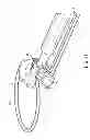 Fig. 18 - System for securing sutures