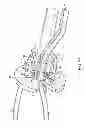 Fig. 22 - System for securing sutures