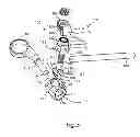 Fig. 04 - System and Method for Bone Anchorage