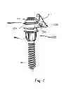 Fig. 08 - System and Method for Bone Anchorage