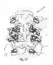 Fig. 23 - System and Method for Bone Anchorage