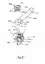 Fig. 34 - System and Method for Bone Anchorage
