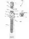 Fig. 37 - System and Method for Bone Anchorage